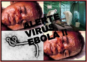 ebola34